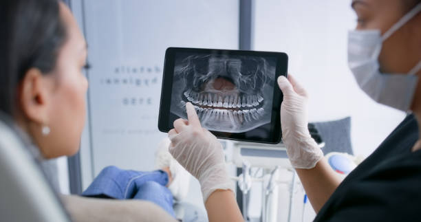Licensed Tooth Extraction service in Los Altos Hills, CA - Smile Center Dentistry